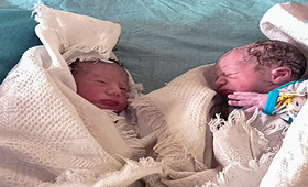 Fatima’s New Born Twins UNFPA_ Syria, Massoud Hassan
